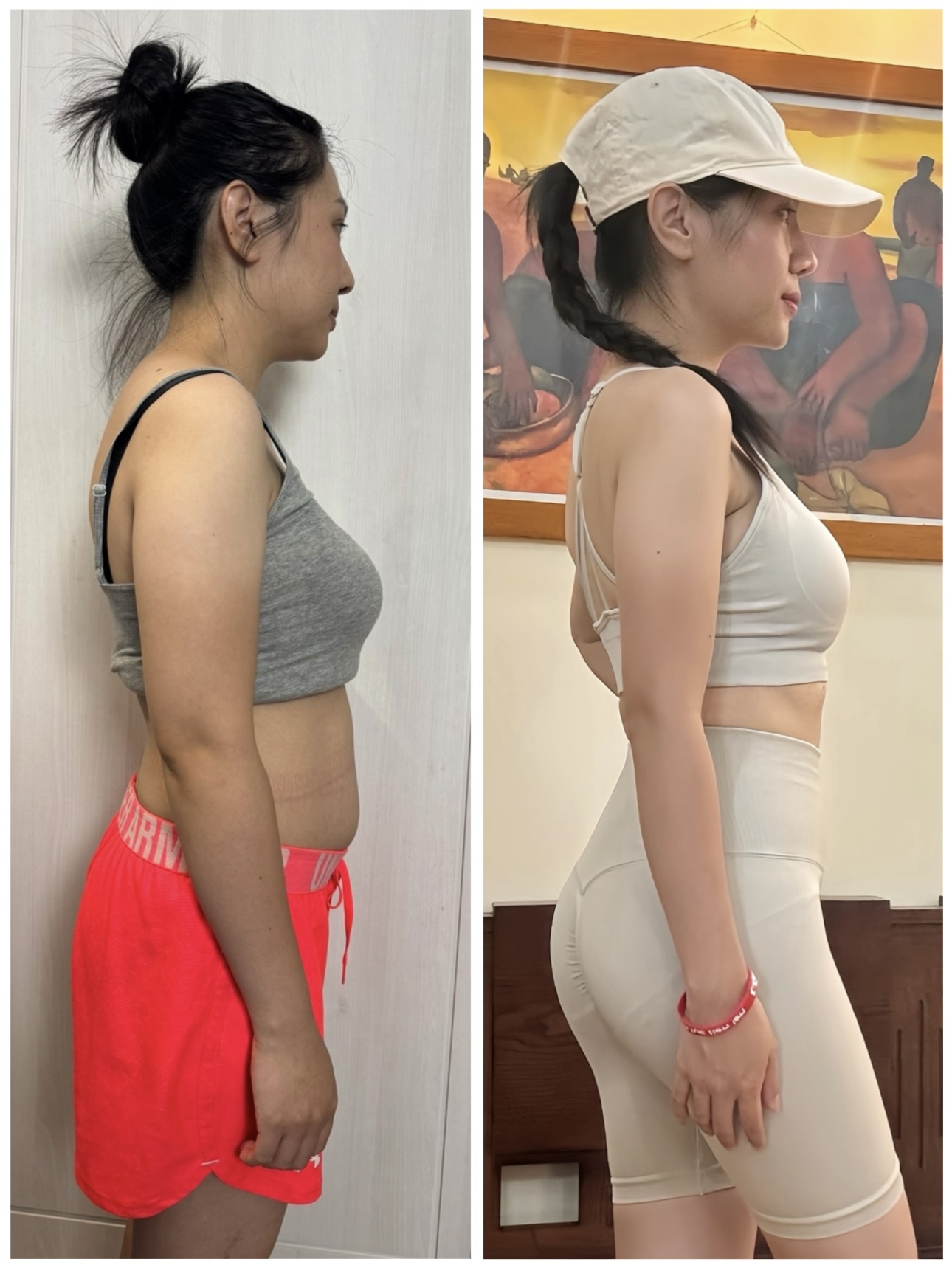 Ảnh trước sau góc nghiêng